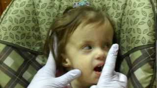 Lilliana Joy Dennis in Feeding Therapy  88th week  Trisomy 18 [upl. by Akenna]