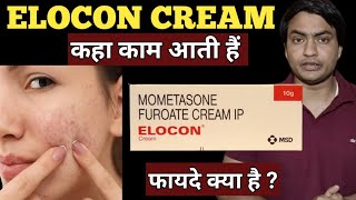 elocon cream  for dark spots  ke fayde  kaise use kare  use in hindi [upl. by Htidirem750]