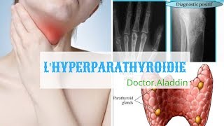 HYPERPARATHROÏDIE  CAUSES  SYMPTÔMES  DIAGNOSTIQUE  TRAITEMENT ET PATHOLOGIE [upl. by Cornwell]