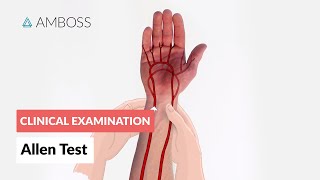 Modified Allen Test  Clinical Examination [upl. by Worrell]