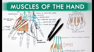 Metacarpal Fractures  Everything You Need To Know  Dr Nabil Ebraheim [upl. by Camey]