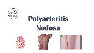 Polyarteritis Nodosa PAN  Signs amp Symptoms Diagnosis Treatment [upl. by Darian]