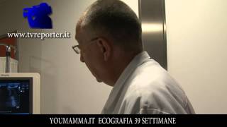 YOUMAMMAIT ECOGRAFIA 34 SETTIMANE [upl. by Odnesor]