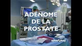 Adénome de la prostate  APHM août 2010 [upl. by Niraj]