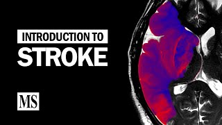 Introduction To Stroke [upl. by Rollie]