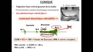 02 Rétrécissement mitral Pr Daimellah  Cardio [upl. by Utimer]