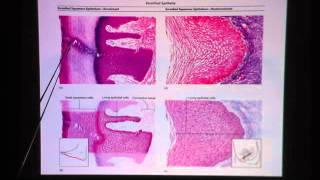 Keratinized Stratified Squamous Epithelium [upl. by Reteid64]