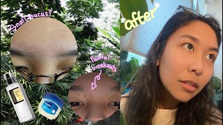 SLUGGING before and after how slugging w Vaseline  corsx snail mucin cured my skin [upl. by Anaerdna]