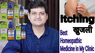 Best Homepathic medicine for itching in my clinic  ep14 part 1 [upl. by Olegnalehcim]