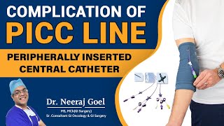 Understanding Complications and Management of Peripherally Inserted Central Catheters PICC line [upl. by Aihsyn]