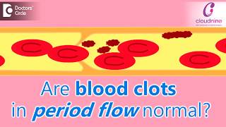 Why does menstrual bleeding have blood clots Is it normalDrShalini Varma of Cloudnine Hospitals [upl. by Yarazed]