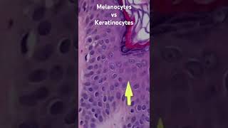 Melanocytes vs Keratinocytes From my normal skin histology 101 video pathology dermpath usmle [upl. by Navada]