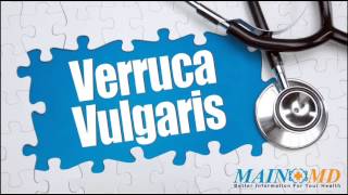 Verruca Vulgaris ¦ Cure Treatment and Symptoms [upl. by Rosner]