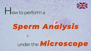 How to perform a sperm analysis under the microscope  urologist göttingen [upl. by Stedt]