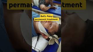 Facial Palsy or Bells Palsy permanent treatment without steroids healwithdr Bells Palsy physio [upl. by Dellora854]