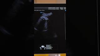 How to Prepare Your Body for IVF ivftreatmentforpregnancyvideo ivftransferprocedurevideo [upl. by Inalel]