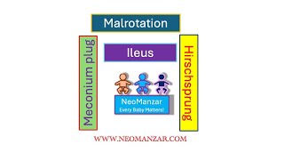 Ileus Plug Malrotation Hirschsprung Neonate [upl. by Ayoras687]