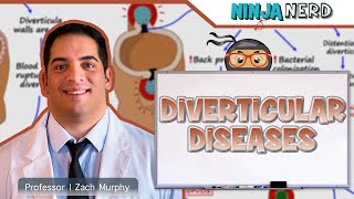 Diverticular Diseases  Clinical Medicine [upl. by Ailatan35]