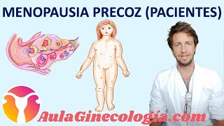 MENOPAUSIA PREMATURA o PRECOZ PACIENTES Necesidad de tratamiento  Ginecología y Obstetricia [upl. by Anailli]