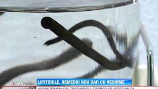 Terapia cu lipitori cea mai nouă metodă de tratament [upl. by Karlan584]