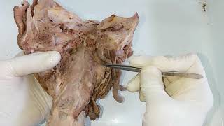 Dissection  Constrictors of Pharynx [upl. by Ayiotal541]