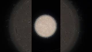 Inside the Lab Sperm Under the Microscope EmbryologyInsights [upl. by Kciwdahc]