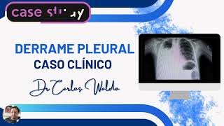 DERRAME PLEURAL CASO CLÍNICO [upl. by Leachim]