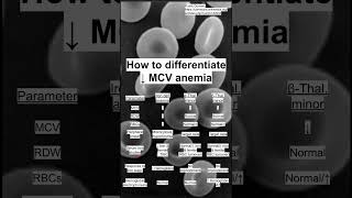 How to differentiate ↓ MCV anemia [upl. by Rochella]