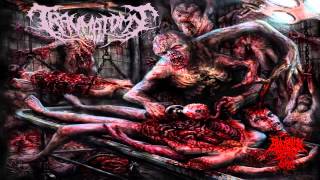 Traumatomy  Beneficial Amputation Excess Limbs 2014 FullEP [upl. by Eenert]