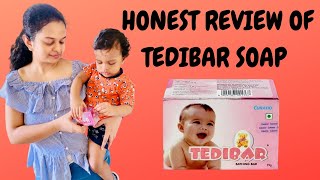 MUST WATCH TEDIBAR soap Honest review TAMIL  Baby fairness soap   Pros and Cons of soap [upl. by Lauder]