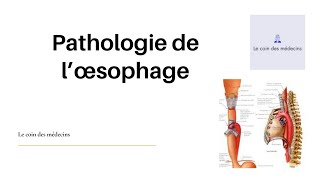 Pathologie de l’œsophage [upl. by Aicercal]