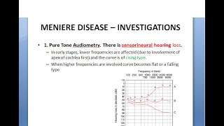 ENT Menieres Disease Part 2 Examination Investigations Diagnosis Staging Ear Check test confirm [upl. by Nonnahc]