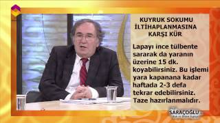 KUYRUK SOKUMU İLTİHABI İÇİN KÜR [upl. by Gaston]