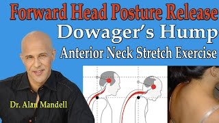 Forward Head Posture Release Dowagers Hump Anterior Neck Stretches  Dr Mandell [upl. by Zanas]