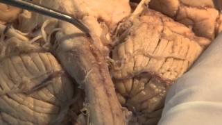 The Most Important Pathway Motor Control Neuroanatomy Video Lab  Brain Dissections [upl. by Ahsinam]