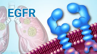 Understanding NSCLC Treatment When You Have an EGFR Mutation [upl. by Sihon]