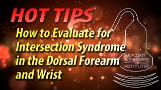 How to Evaluate for Intersection Syndrome in the Dorsal Forearm and Wrist [upl. by Nylrehs]