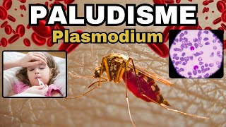 Tout savoir sur le PALUDISME  MALARIA  Plasmodium Cycle Diagnostic Traitement [upl. by Frydman662]