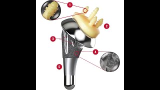 Anatomic Total Shoulder Replacement Education [upl. by Bowler]