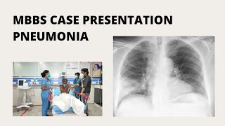 MBBS Case Presentation  Pneumonia [upl. by Brookes862]