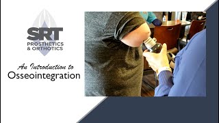 An Introduction to Osseointegration [upl. by Merritt]