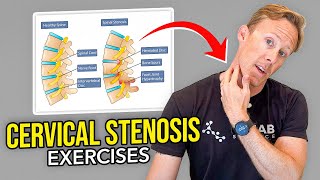 5 Exercises for Cervical Stenosis Arm Nerve Pain [upl. by Mal]