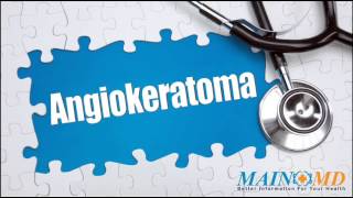 Angiokeratoma ¦ Treatment and Symptoms [upl. by Glennie]