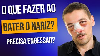 O que fazer ao bater o nariz Trauma nasal ou Nariz quebrado [upl. by Cavallaro435]