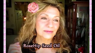 RoseHip Seed Oil amp Why You Have To Have It [upl. by Noyk990]