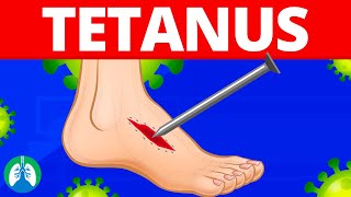 Tetanus Medical Definition  Quick Explainer Video [upl. by Cindelyn]