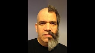 2 Months Of Beard Growth  Time Lapse [upl. by Goodman]