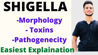 Shigella microbiology Shigella pathogenesis  shigella toxin  shigellosis [upl. by Jorrie]