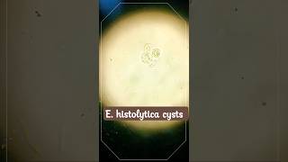 E histolytica cysts  Amoebiasis [upl. by Nandor]