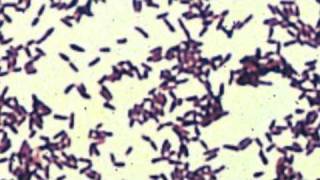 corynebacterium [upl. by Dallon]